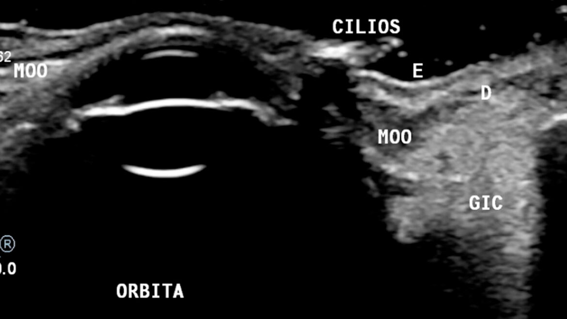 AVALIAÇÃO DE ESTRUTURAS FACIAIS