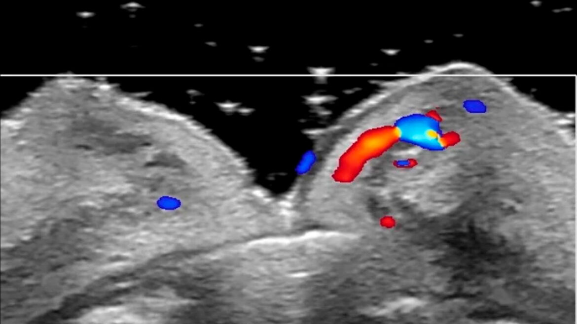 AVALIAÇÃO VASCULAR
