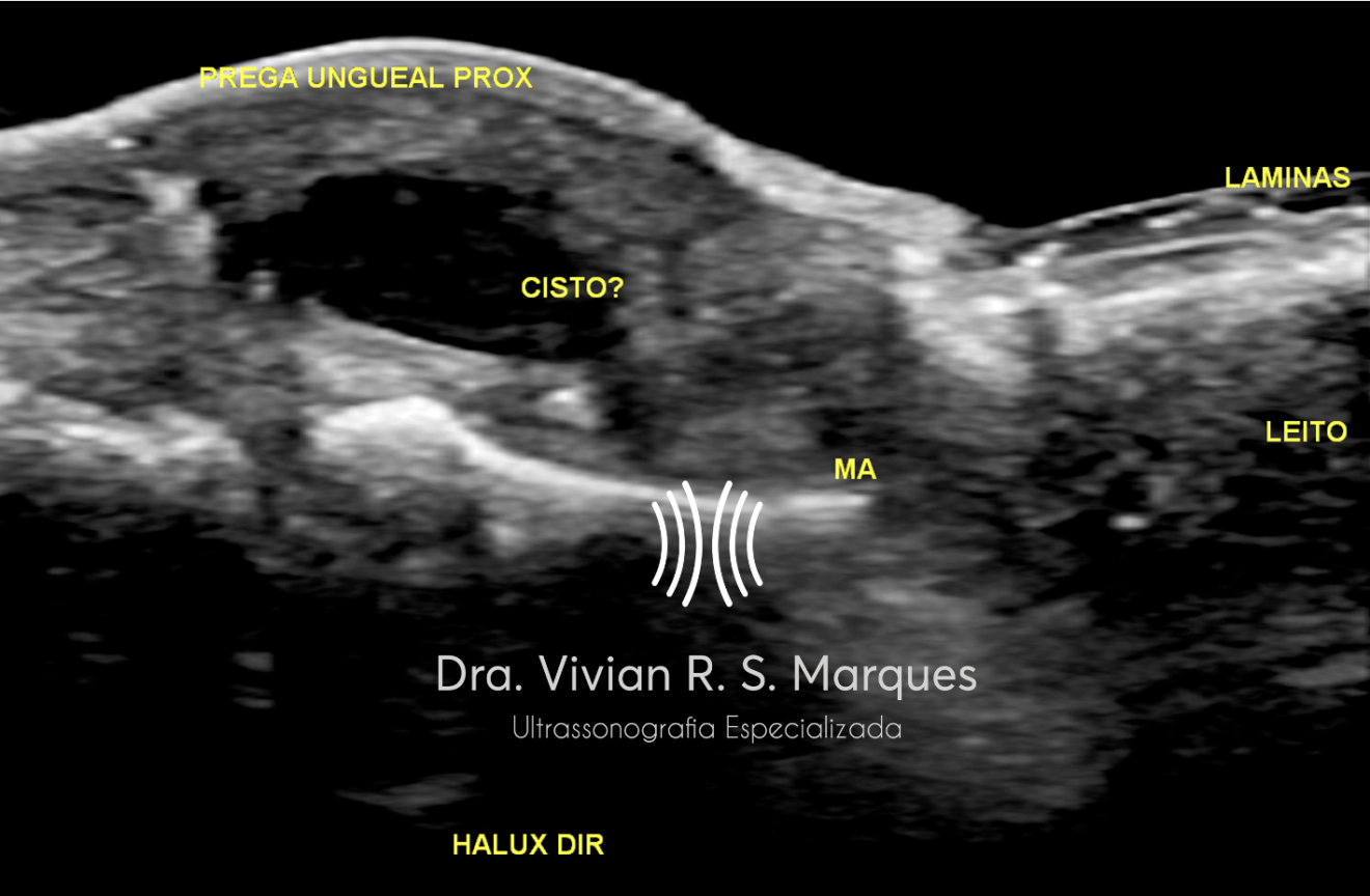 Conheça Mais Sobre A Ultrassonografia Dermatológica - Dra Vivian